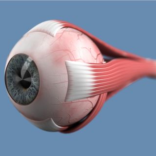 Alivio de la Tensión Ocular